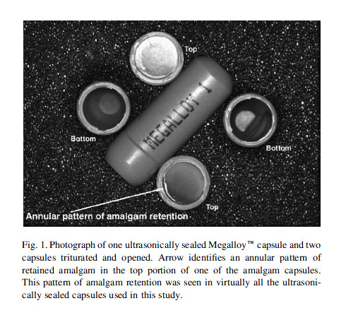 amalgam-capsules-fig1