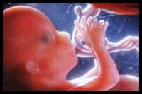 fetus01