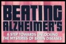 Book Review: Beating Alzheimer's A Step Towards Unlocking the Mysteries of Brain Diseases by Tom Warren 