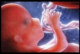 Maternal-fetal distribution of mercury released from dental amalgam fillings